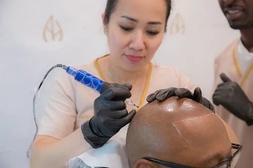 Scal Scar Camouflage, Hair Simulation and Stimulation